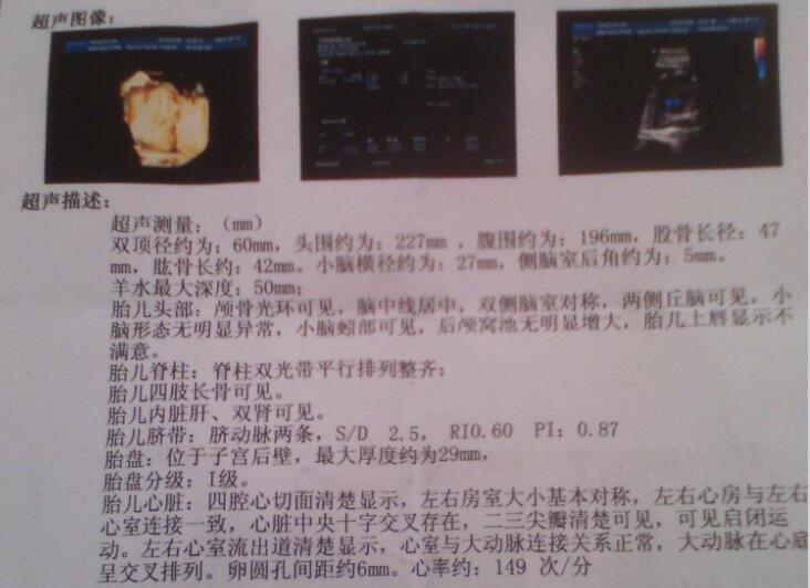 孕晚期b超胎儿发育对照表,胎儿发育超声检查正常值