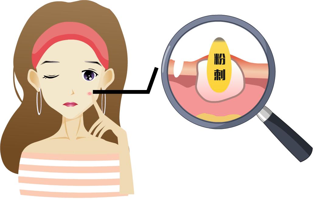 战痘全攻略4种痘痘的祛痘秘诀,战痘到底5个预防痘痘的小秘诀