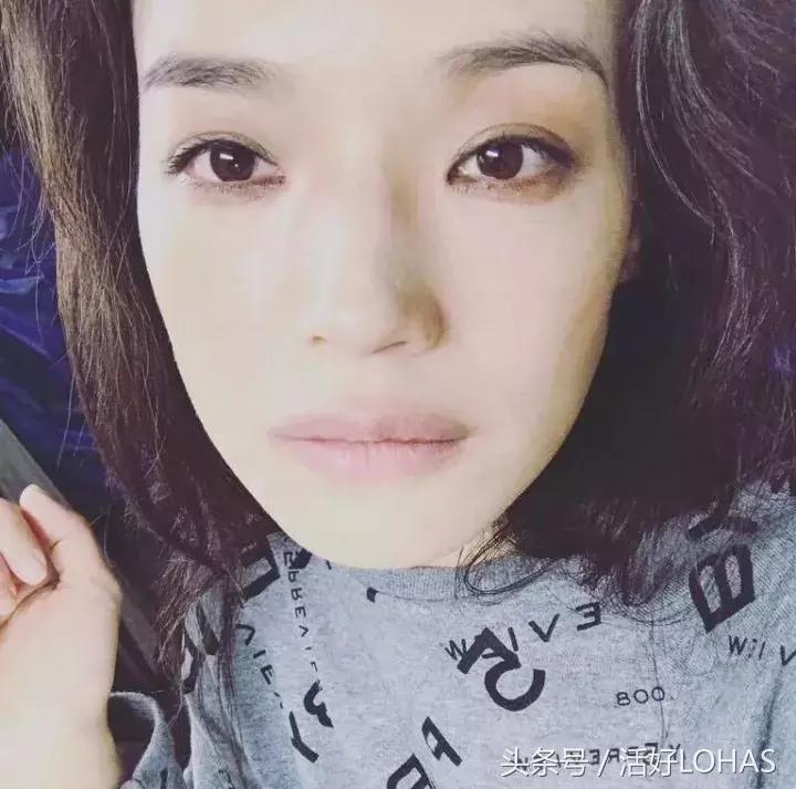 拯救发际线的生发神器,拯救发际线神器