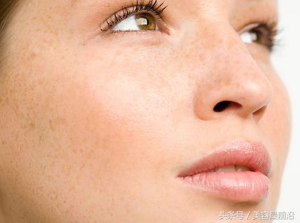 小孩脸上有雀斑怎么去掉,去掉脸上雀斑的最好办法
