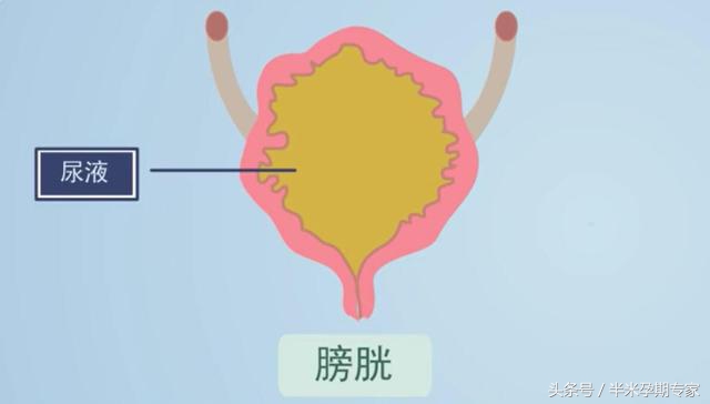 产后不能正常排尿很危险要马上采取这几个措施