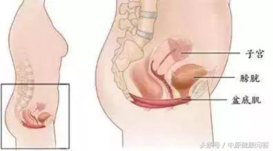 一打喷嚏就漏尿，女子被这病折磨好些年，终于治疗好