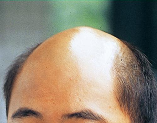 男人一生要过的6道健康关卡