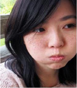 各种斑的特点区别,16种斑如何分析鉴别