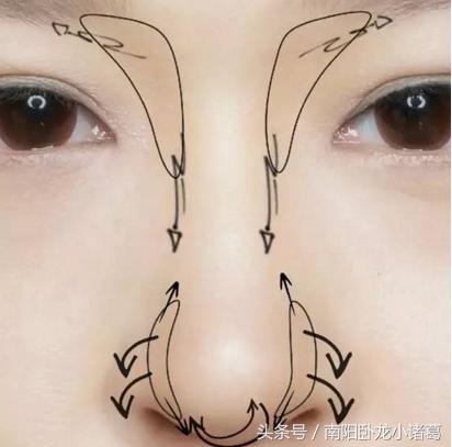 南阳时光整形除皱术,南阳时光假体隆鼻