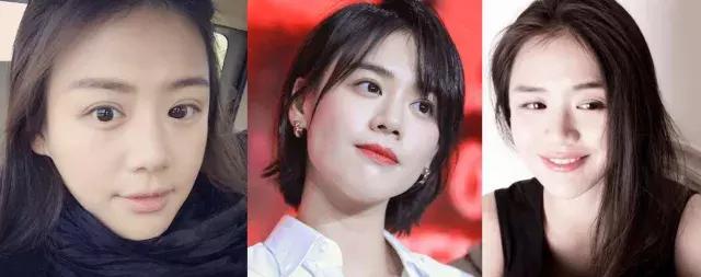 如何刷酸祛痘缩小毛孔,刷酸正确的护肤步骤痘痘肌