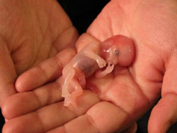 堕胎的胎儿遗体怎么处理,打胎后胎儿遗体怎样处置