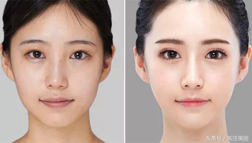 打完除皱瘦脸针多久能洗脸敷面膜,打完瘦脸针多久可以躺下睡觉