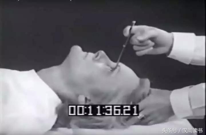 他用一根长钉从眼眶锤入那个人的头颅竟只为了治精神病