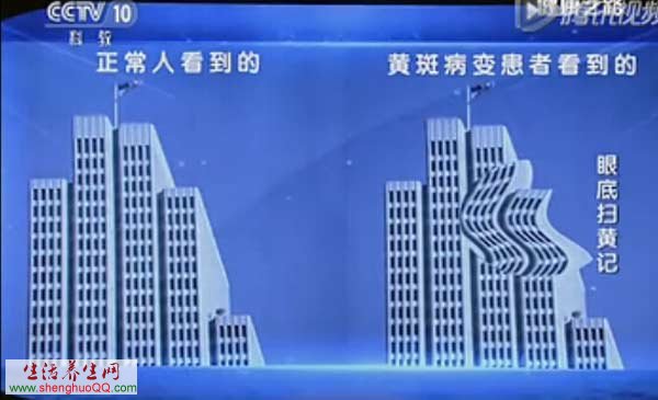 眼底黄斑变性通过什么检查,眼底黄斑变性手术治疗方法