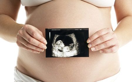 产检的十个建议,产检必须知道的16件事