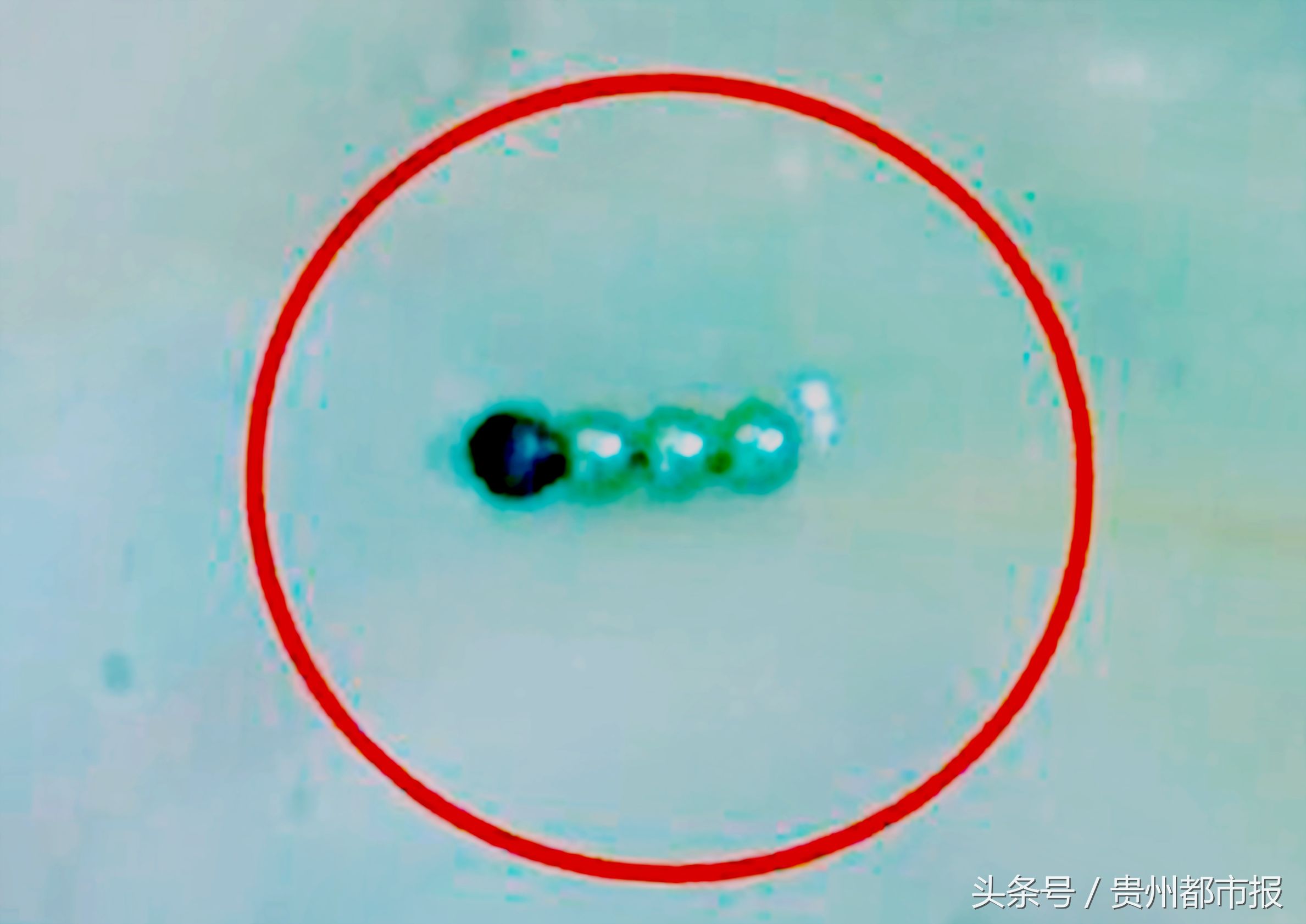 小孩误吞两厘米长椭圆形磁铁,小孩误吞1颗磁铁珠怎么办