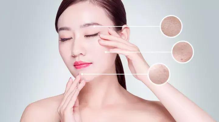 皮肤科医生教你去脸上长斑,皮肤医生讲斑的分类