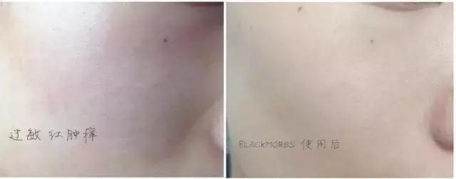 王丽坤范冰冰,王丽坤baby推荐面膜