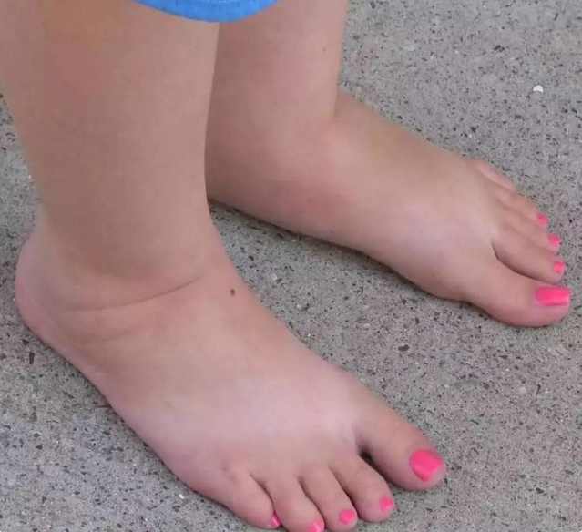 女生怎样能让脚变香,经常按摩脚能使脚变瘦吗