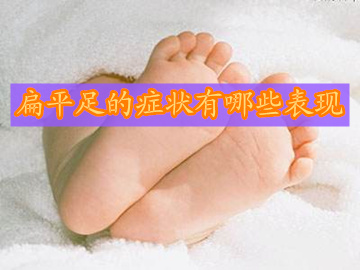 扁平足的认识和方法,扁平足筋膜炎的症状及治疗方法