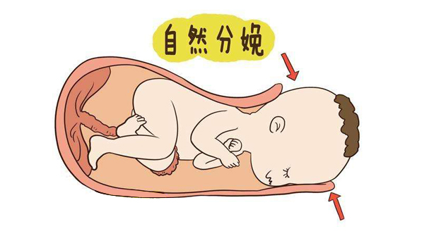 能顺产尽量顺产吗,孕妇能自由选择剖腹产跟顺产吗