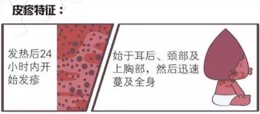 猩红热最新疫情报告发布,猩红热儿童预防
