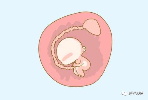 羊水栓塞的主要治疗方案,羊水栓塞的诊断要点