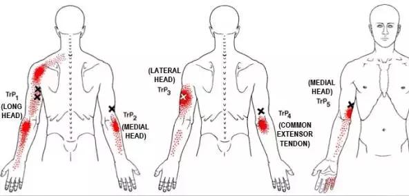 怎么放松手臂肌肉？最全的方法教给你！