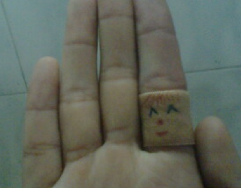 不小心划破手该怎么办,手划破了怎么处理没有碘伏