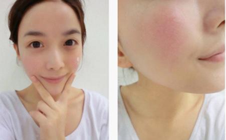 铦舵浮闈㈤儴鎶ょ悊,铦舵浮淇鍑濊兌