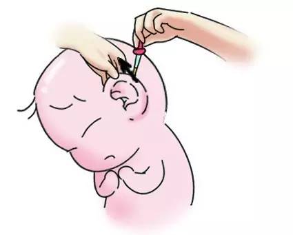 崔玉涛谈护理婴儿需要枕枕头吗,崔玉涛谈幼儿耳朵痒