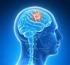 脑肿瘤做完手术发烧咋回事,脑部肿瘤手术后头痛怎么办