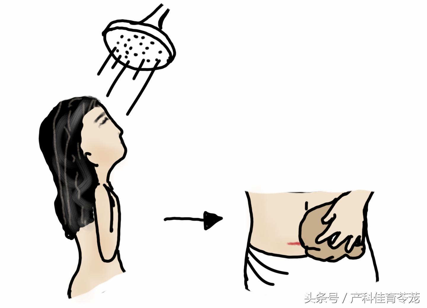 剖宫产术后切口回声改变,剖宫产术后切口改变有问题吗