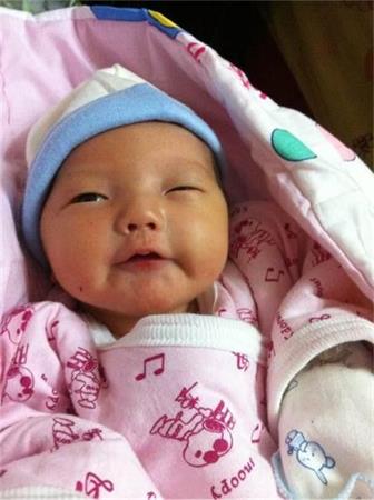 认识新生儿黄疸及其处理方法，新手父母不用慌！