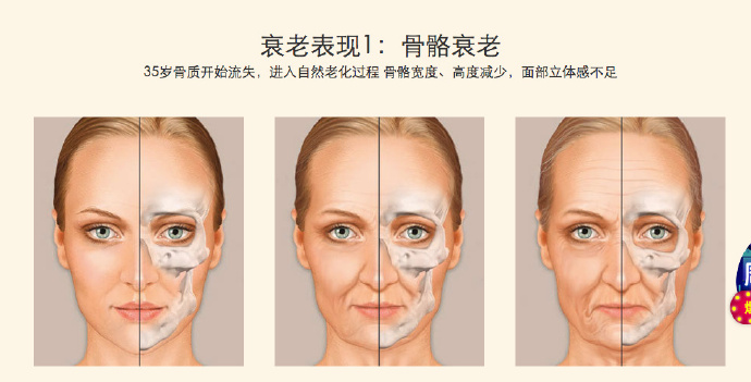 线雕的注意事项和方法,线雕提升讲解视频