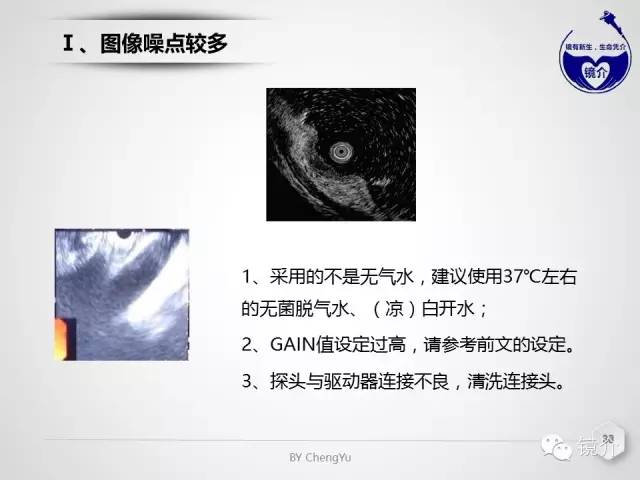 内镜超声小探头设定、使用、维护要点分析