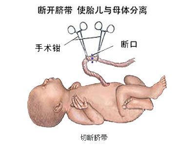 对于选择剖腹产的孕妈妈而言,到底剖腹产是怎样的?(图解)