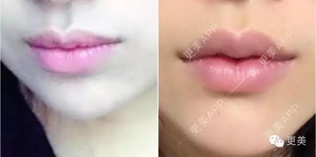 自从有了M唇，再也不愁撩男神~