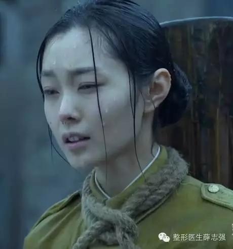 科普｜隆鼻假体，你知道不知道的那些事儿——扒一扒硅胶和膨体