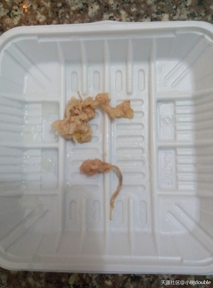 宝宝吃了有寄生虫的东西怎么办,宝宝吃到蔬菜里的虫卵