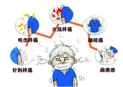 带状疱疹得过一次是否会终身免疫,带状疱疹是一次就终身免疫的吗