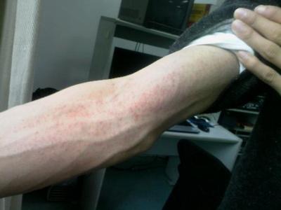 身体缺东西去医院查什么,身体缺啥应该查啥