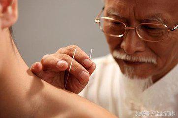 针灸养生可以让人运气好吗,经常做针灸对身体有什么好处
