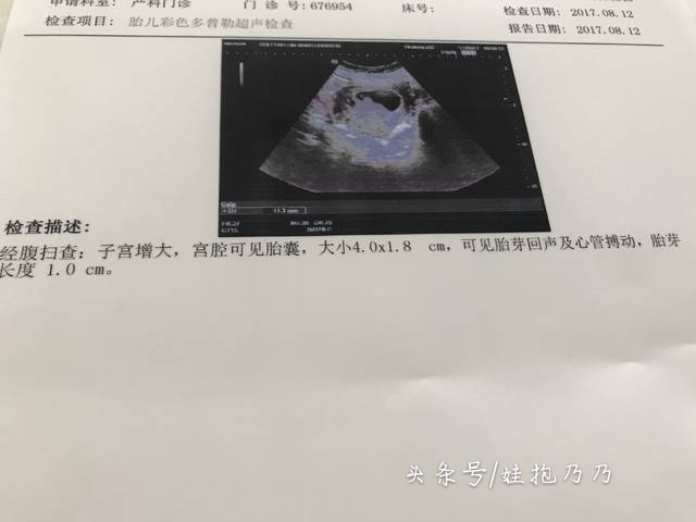 b超检查没有胎动但是胎心正常,b超查不到胎心胎芽还有希望吗