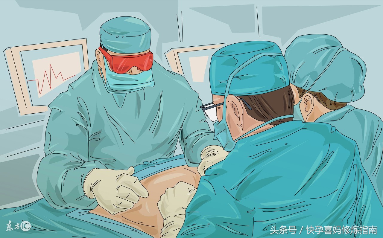 宫腹腔联合手术输卵管积水,左侧输卵管远端积水能自然怀孕吗