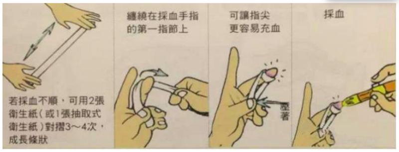 扎手指测血糖不痛有何诀窍,测血糖一天扎七次手指有必要吗