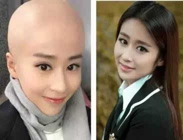 盘点女明星们的光头造型,女星罕见光头照哪个能惊艳到你