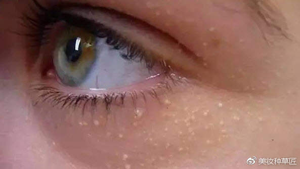 有关眼霜知识,眼霜都有什么故事