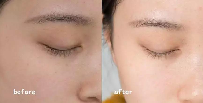 小黑瓶为什么是红色,小黑瓶是不是白里透红