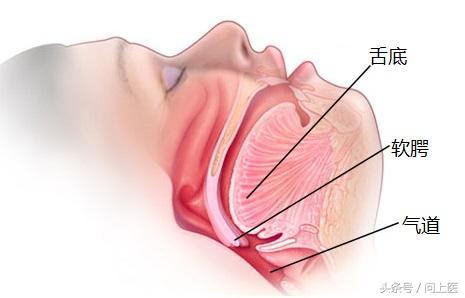 儿童打鼾的原因和治疗方法,打鼾是什么原因引起的怎么治疗
