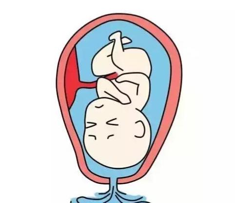 生孩子时，先破水还是先见红？其实差别挺大的！