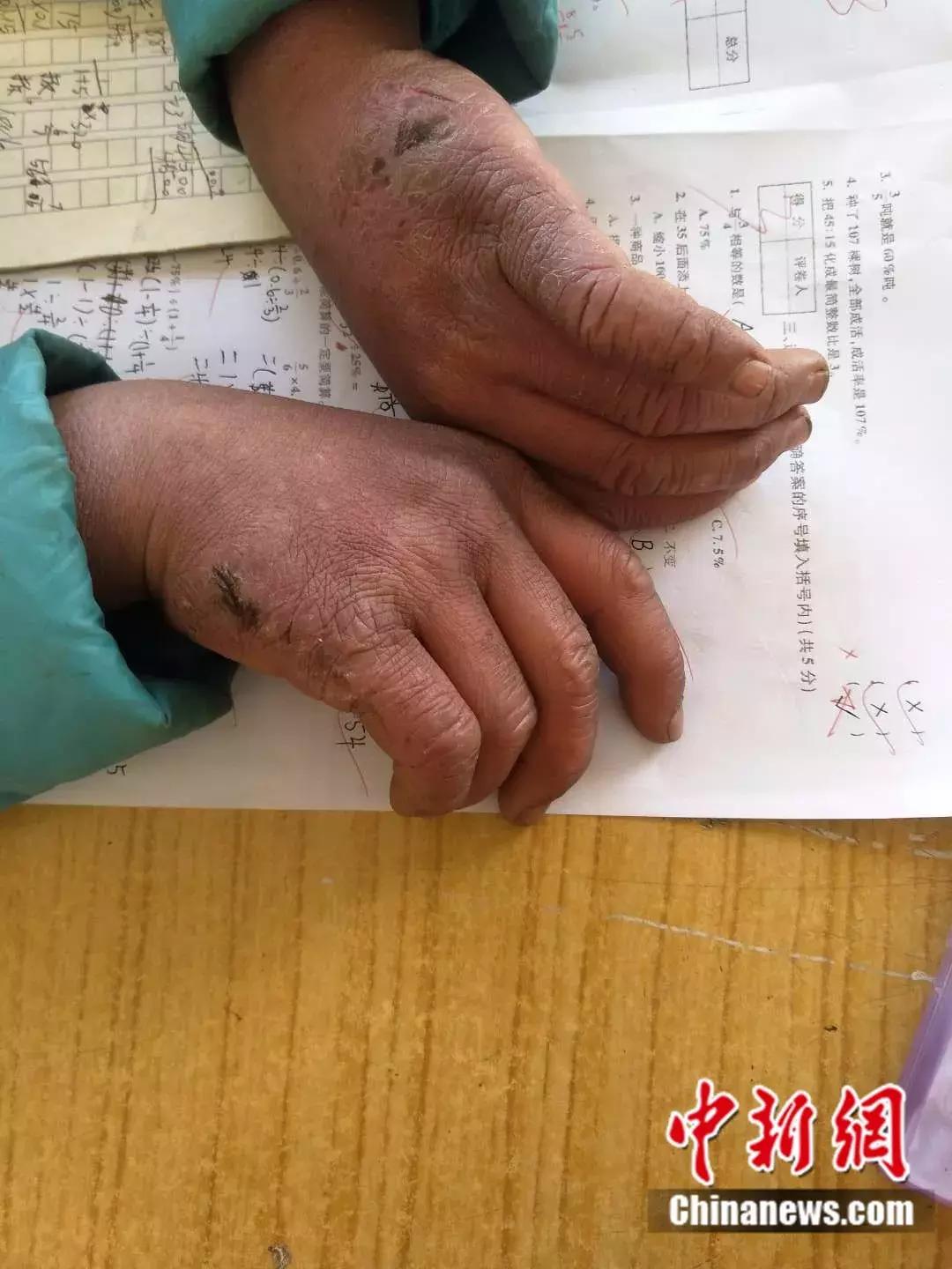 全网都在心疼这个男孩原视频,全网都在心疼这个十九岁男孩