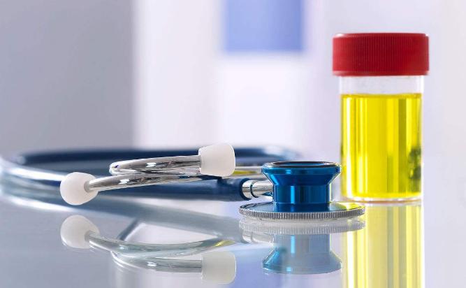 尿潜血1+阴性是怎么回事严重吗,尿潜血1+镜下红细胞1是什么意思