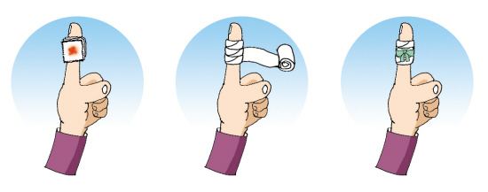 孩子擦破皮的脸需要怎么处理,小孩被刀片划伤伤口很深要缝针吗